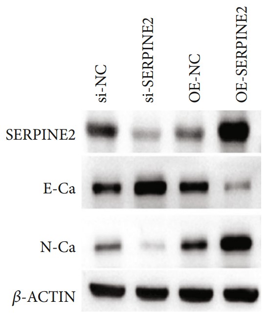 Western blot analysis of E-cadherin and N-cadherin.jpg